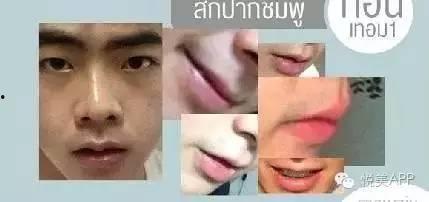 哪些明星做了美容冠,揭秘明星们闪耀笑容背后的秘密