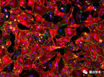 高荧光强度网织红偏低
