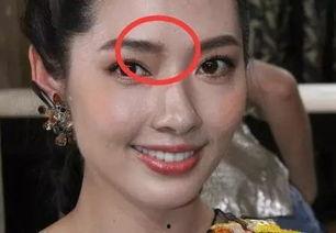 女明星谁脸上有疤,揭秘拥有独特印记的女明星