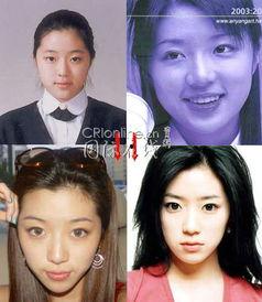 韩国整容明星整容前后图片,蜕变之路，揭秘整容前后惊人对比