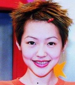 下巴整容失败明星,明星的美丽代价与反思